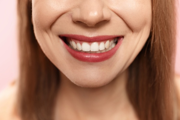 Healing Tips For Implant Supported Dentures